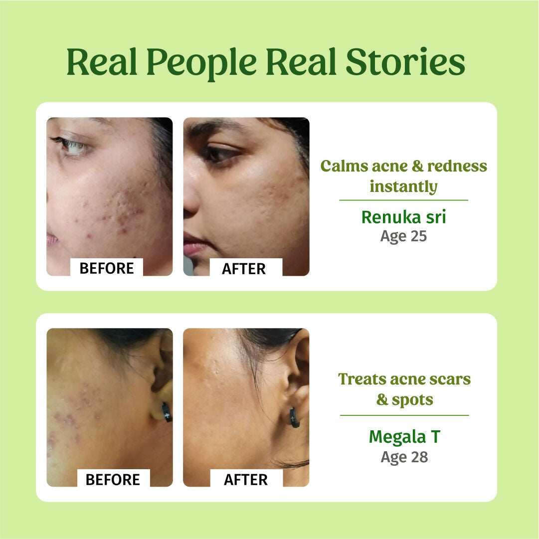 Vilvah Store Aloe Vera Gel (Multi-Purpose Skin & Hair Care)  Grab2Buy Vilvah Store Grab2Buy