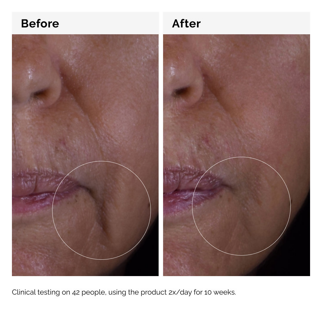 The Ordinary Growth Factors Solution 15% Serum  Grab2Buy The Ordinary Grab2Buy