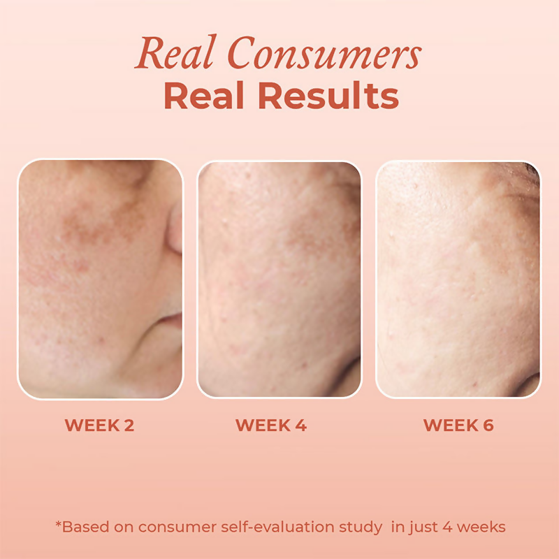 The Pink Foundry Dark Spot & Hyperpigmentation Face Serum  Grab2Buy The Pink Foundry Grab2Buy