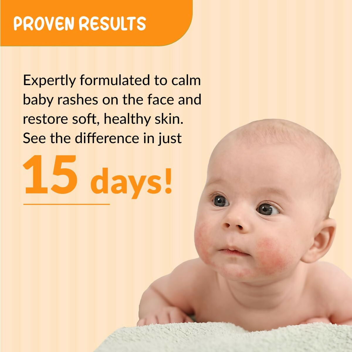 Fixderma Hoopoe Baby Anti-Rash Face Cream 