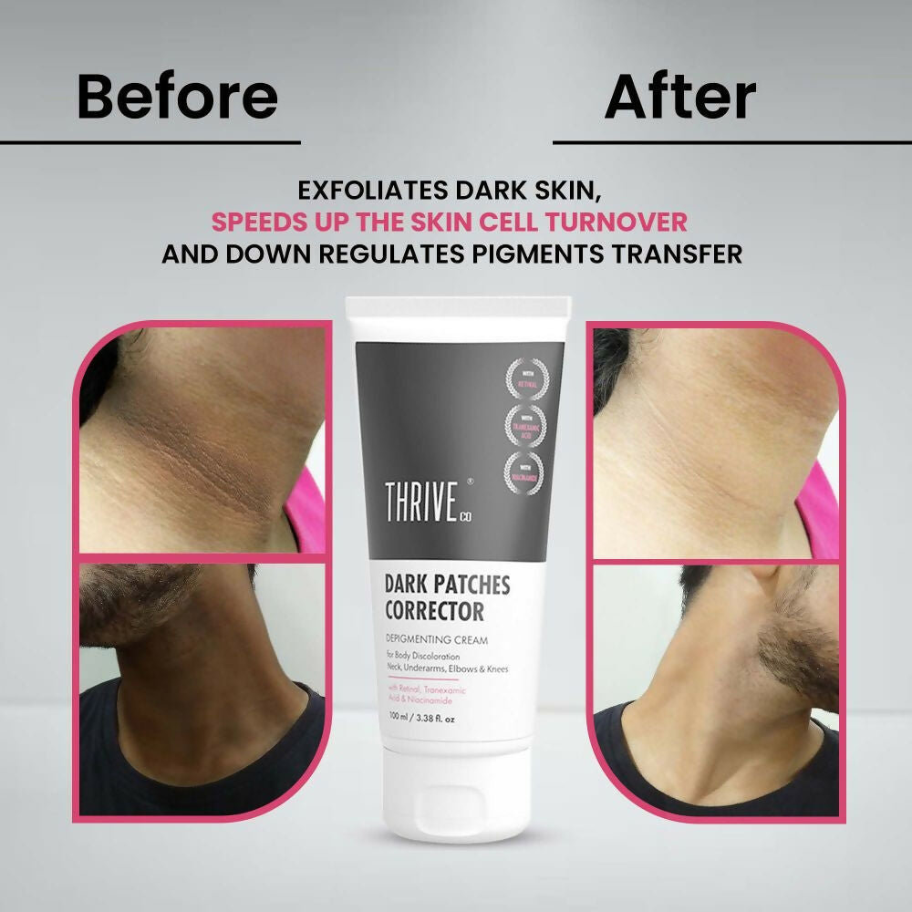 Thriveco Dark Patches Corrector Cream 