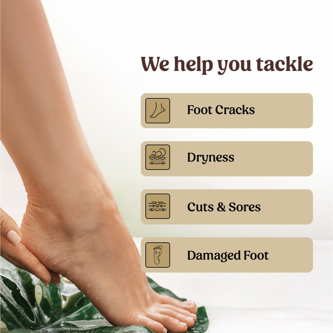 Vilvah Store Foot Cream (Treats Cracked Heels)  Grab2Buy Vilvah Store Grab2Buy
