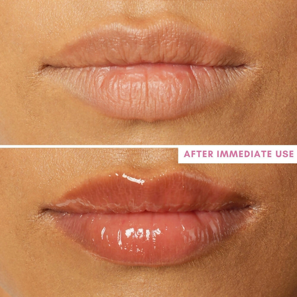 The Skin Diet Company Lip Barrier Oil Clear Gloss with Peptides Hydrates, For Dry & Pigmented Lips  Grab2Buy The Skin Diet Company Grab2Buy