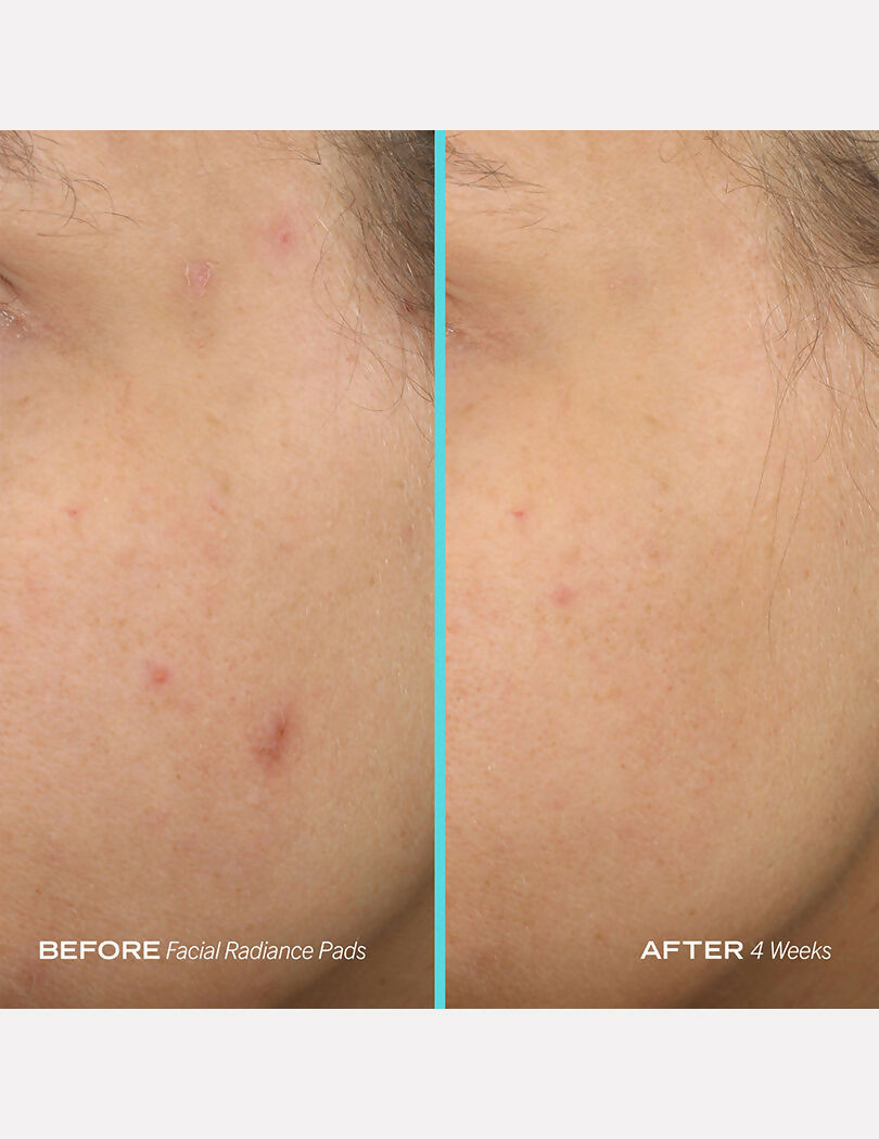 First Aid Beauty Facial Radiance Pads  Grab2Buy First Aid Beauty Grab2Buy