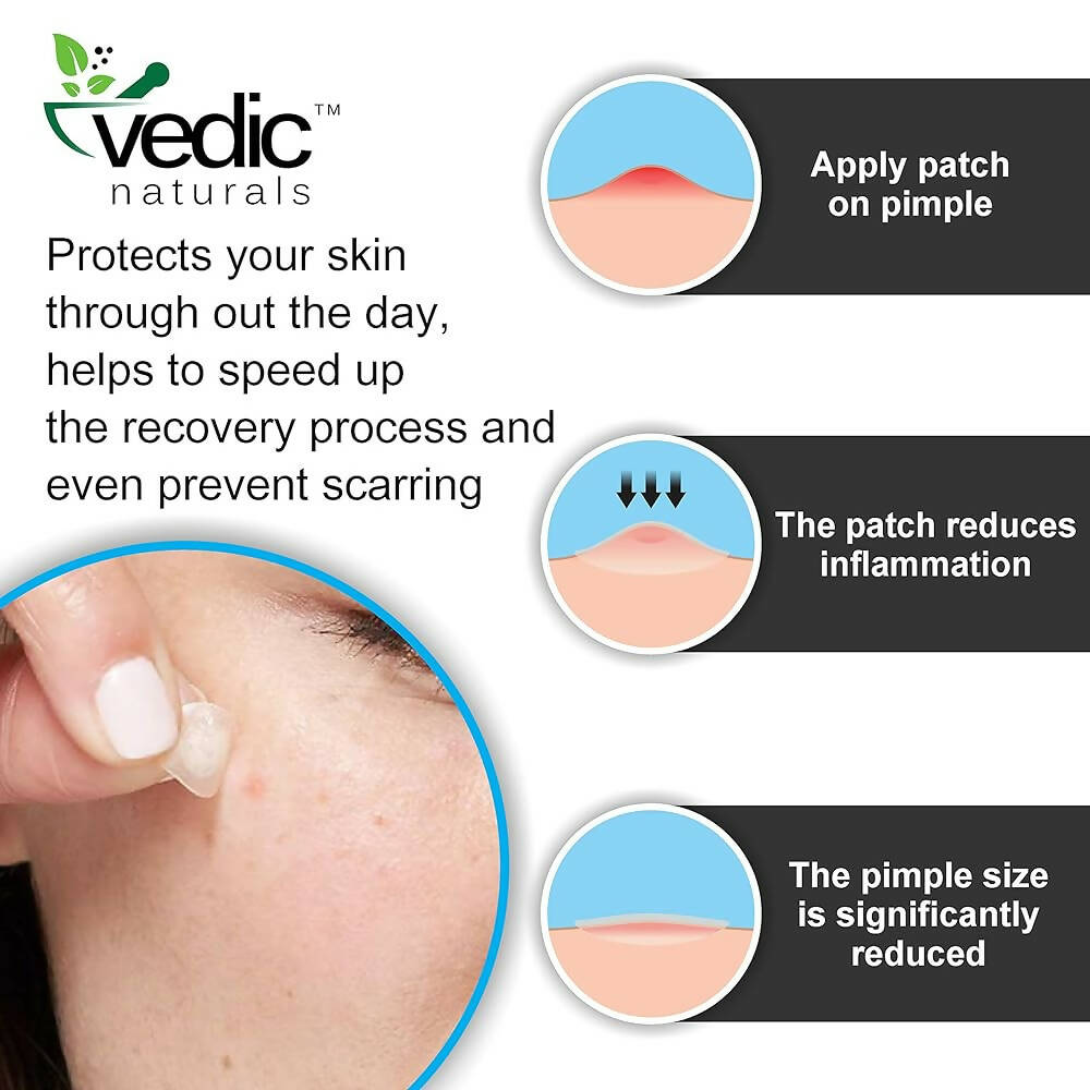 Vedic Naturals Acne Pimple Patches For Face & Skin Treatment  Grab2Buy Vedic Naturals Grab2Buy