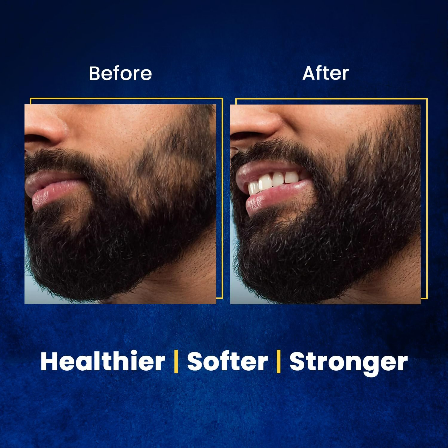 The Beard Story Beard Oil For Men  Grab2Buy The Beard Story Grab2Buy