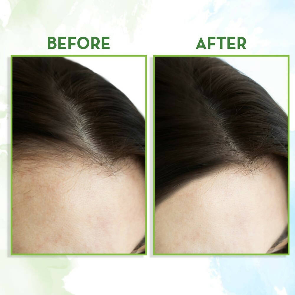 Mamaearth Rosemary Hair Growth Oil with Rosemary & Methi Dana - Grab2buy