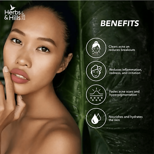 Herbs & Hills Anti Acne Face Pack 