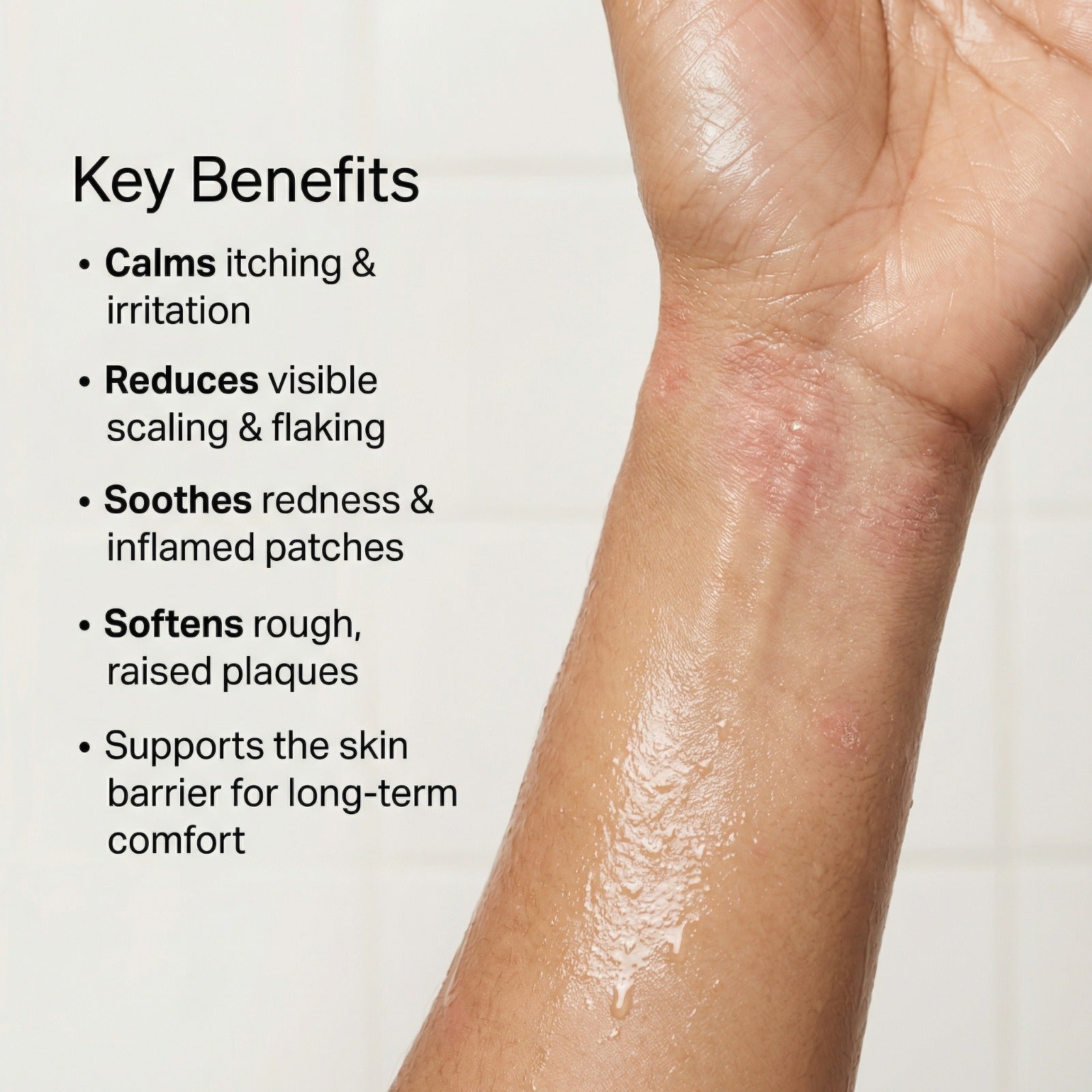 Vedicderm Psoriasis Cream  Grab2Buy VedicDerm Grab2Buy