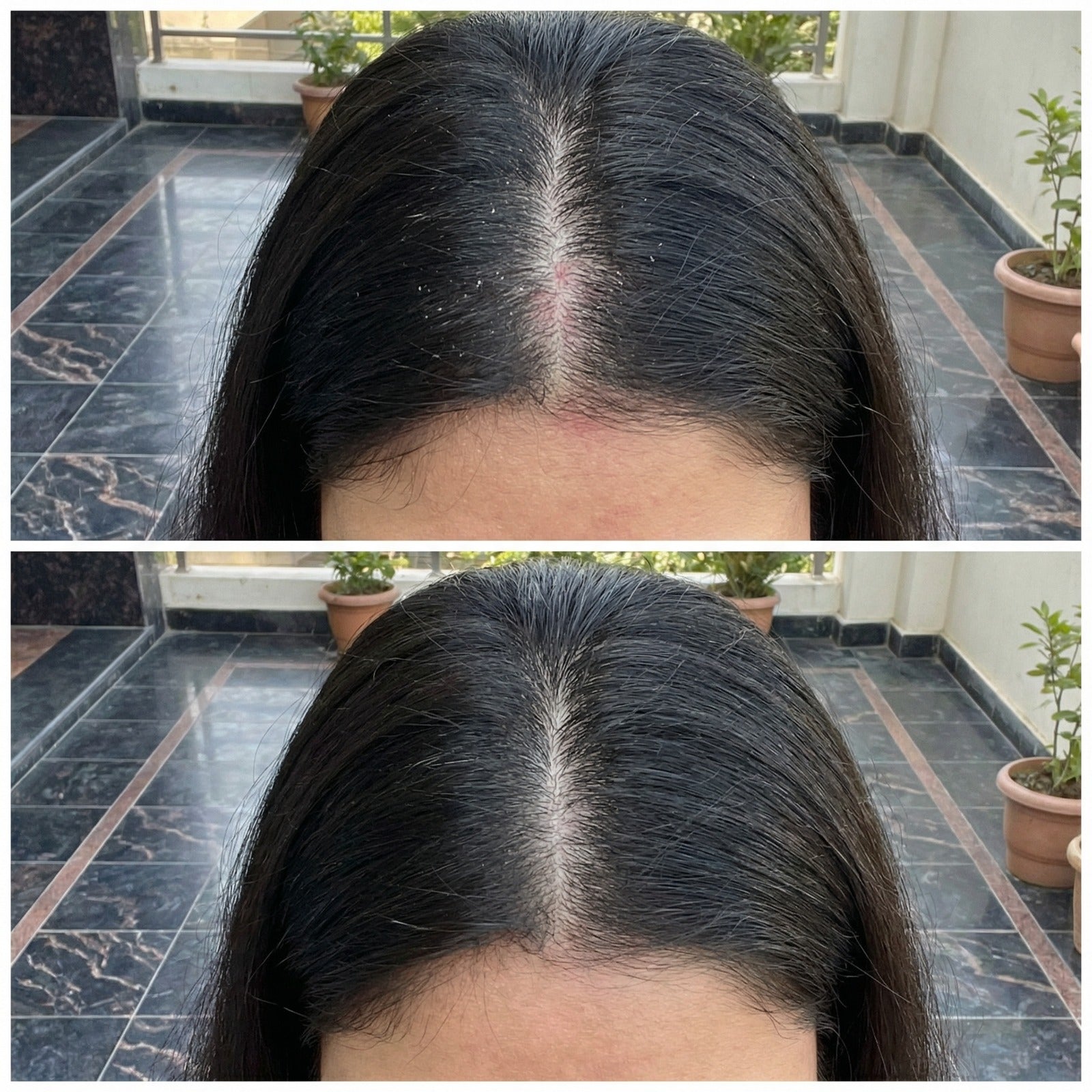 Vedicderm Psoriasis Oil 2-in-1 Skin + Scalp Relief Oil  Grab2Buy VedicDerm Grab2Buy