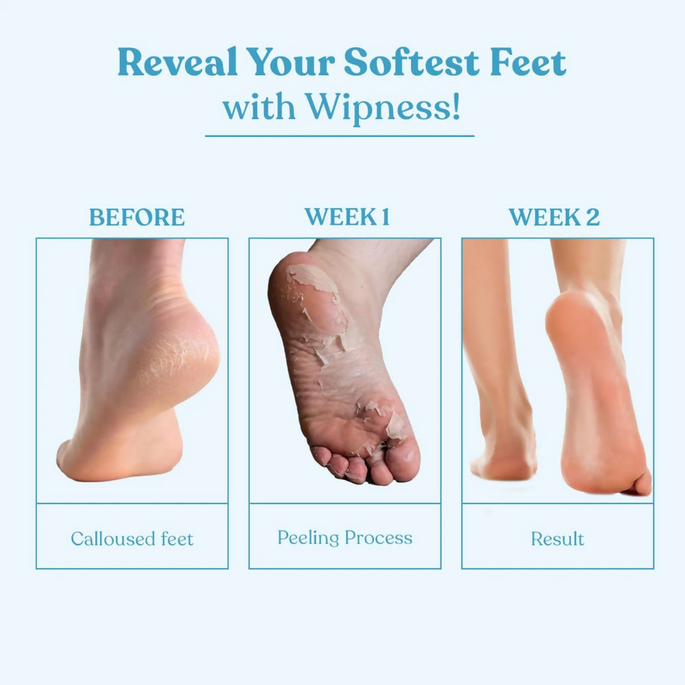 Wipness Natural Foot Peeling & Exfoliating Foot Mask  Grab2Buy Wipness Grab2Buy