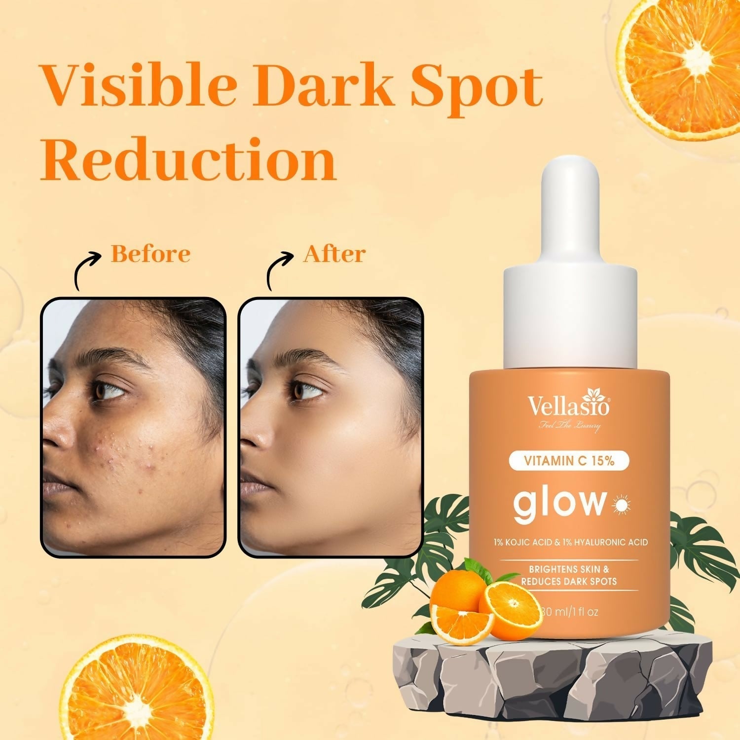 Vellasio 15% Vitamin C Serum with Hyaluronic Acid & Kojic Acid  Grab2Buy Vellasio Grab2Buy