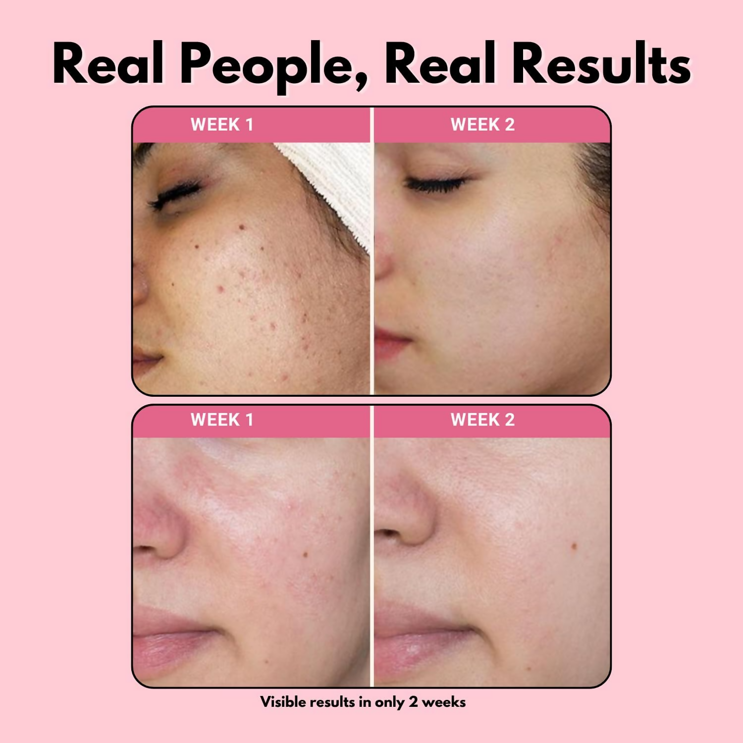 FSAS Health and Beauty Face Combo of Face Hydrator + Green Tea Foaming Face Cleanser