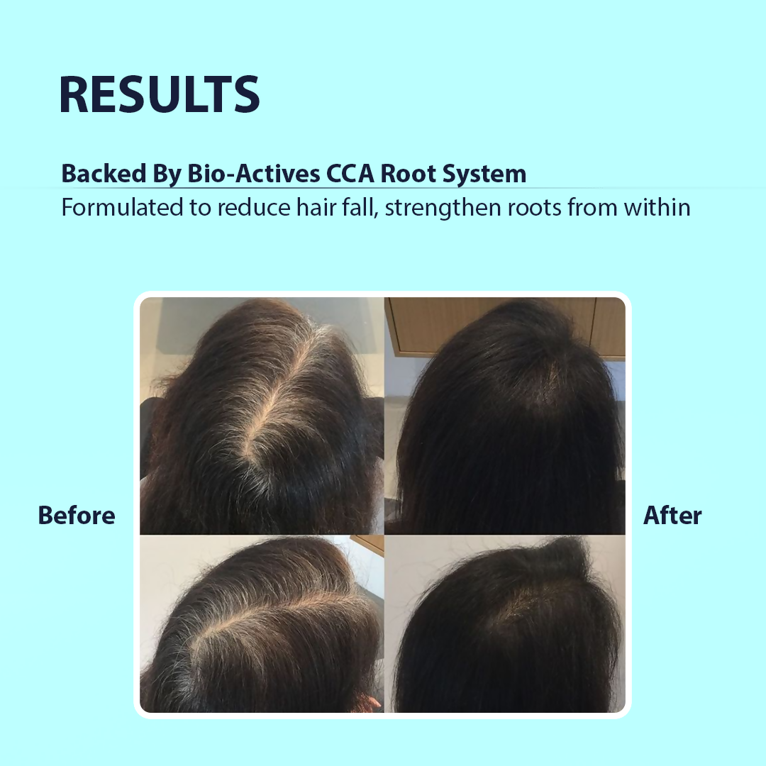 Dermistry Caffeine Collagen Wheat Protein Anti-Hair Fall Control Shampoo
