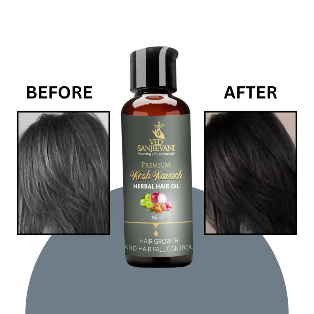 Ved Sanjeevani Kesh Kavach Herbal Hair Oil  Grab2Buy Ved Sanjeevani Grab2Buy