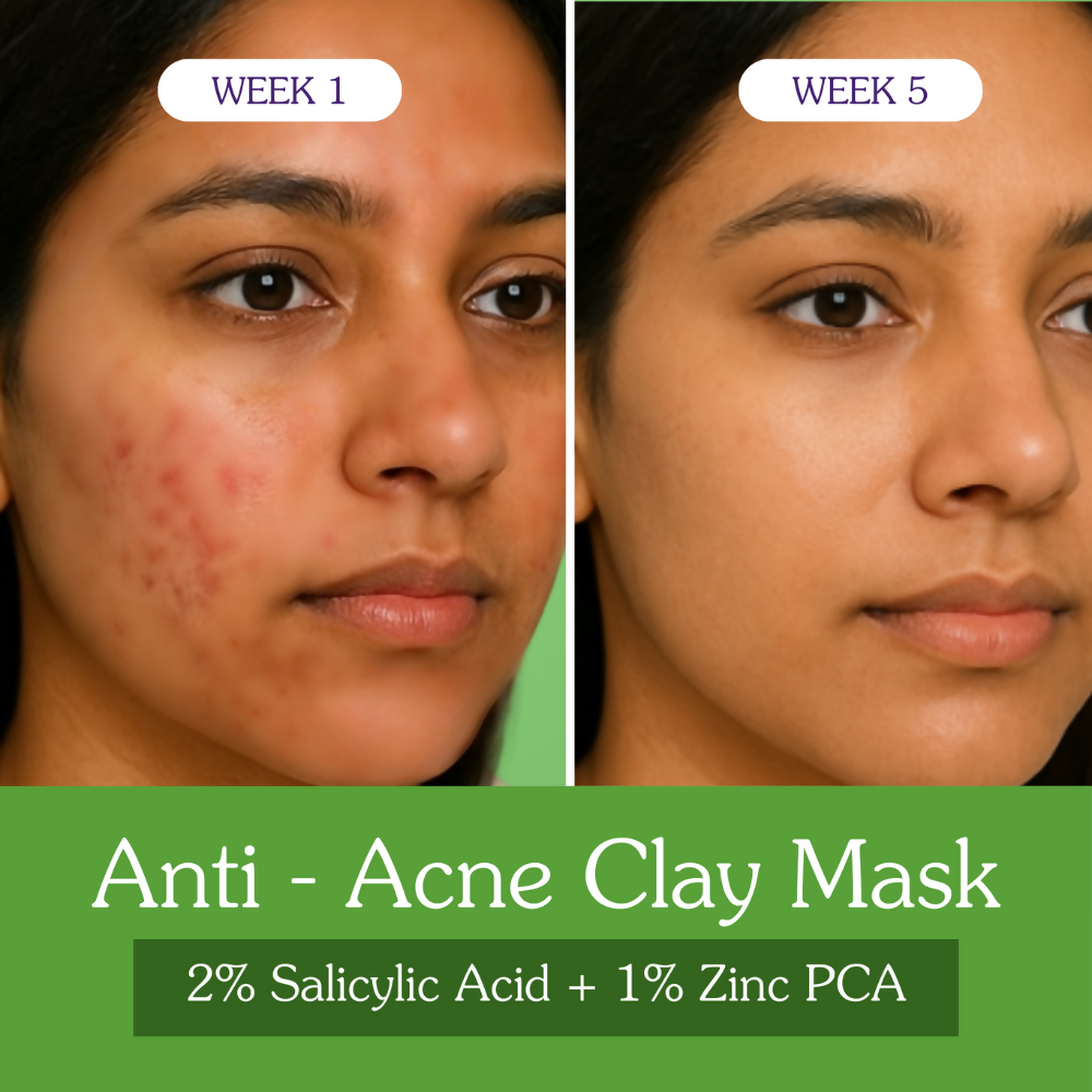 Bake 2% Salicylic Acid + Zinc PCA Anti-Acne Clay Mask | Swadesiicart