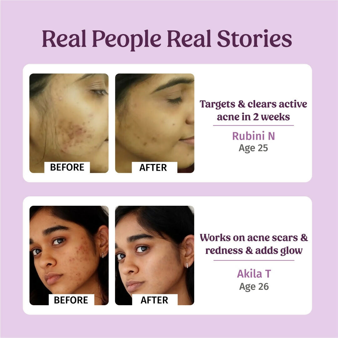 Vilvah Store Honey Fix Face wash (10% Raw Honey)  Grab2Buy Vilvah Store Grab2Buy
