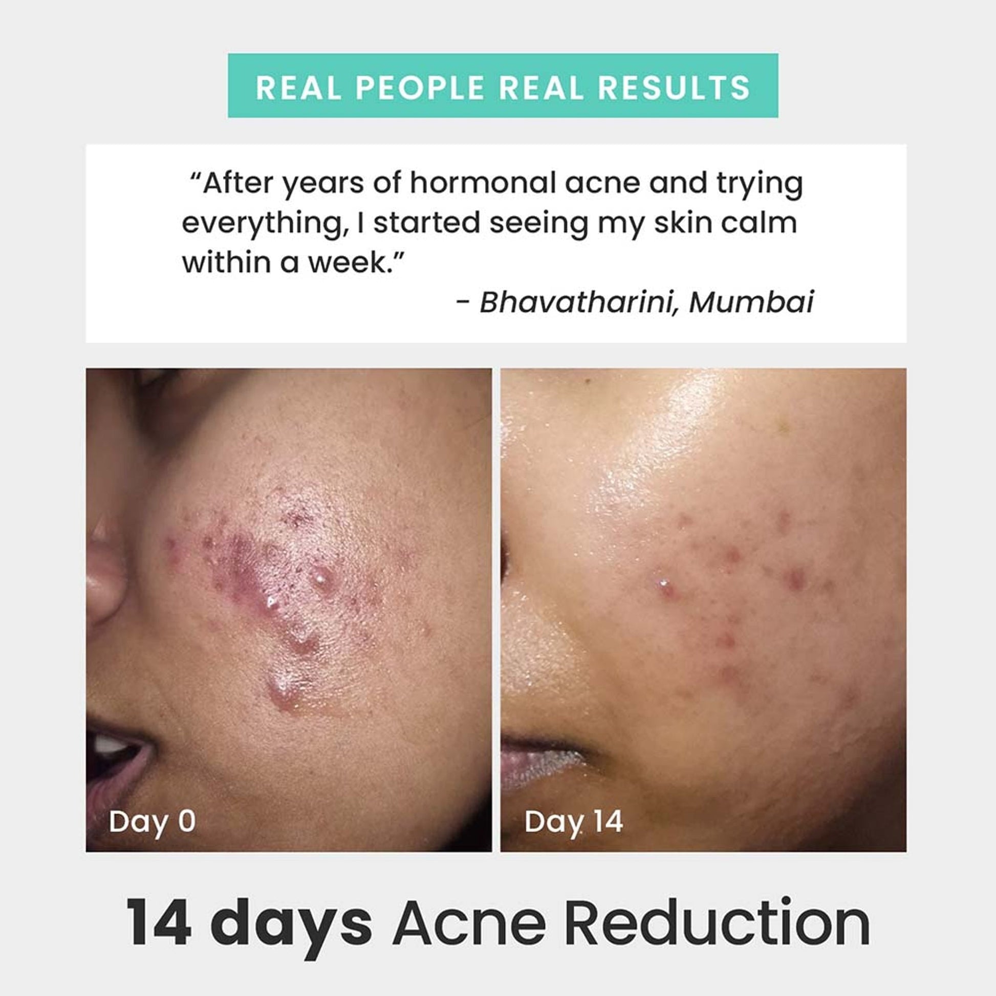 The Solved Skin Rapid Clear Face Wash  Grab2Buy The Solved Skin Grab2Buy