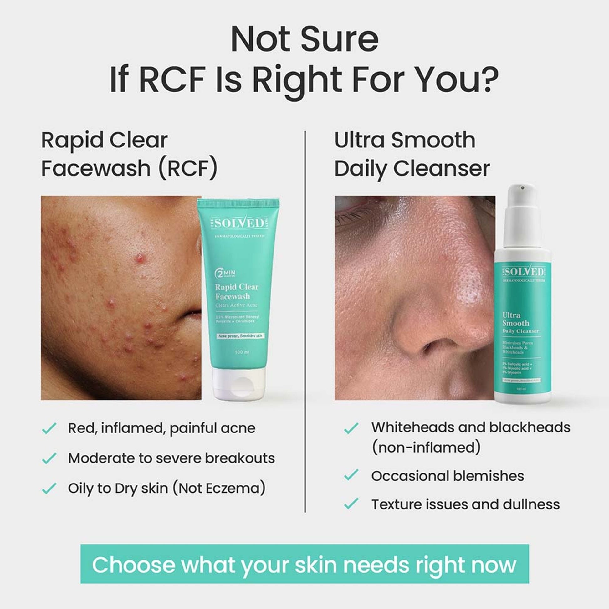 The Solved Skin Rapid Clear Face Wash  Grab2Buy The Solved Skin Grab2Buy