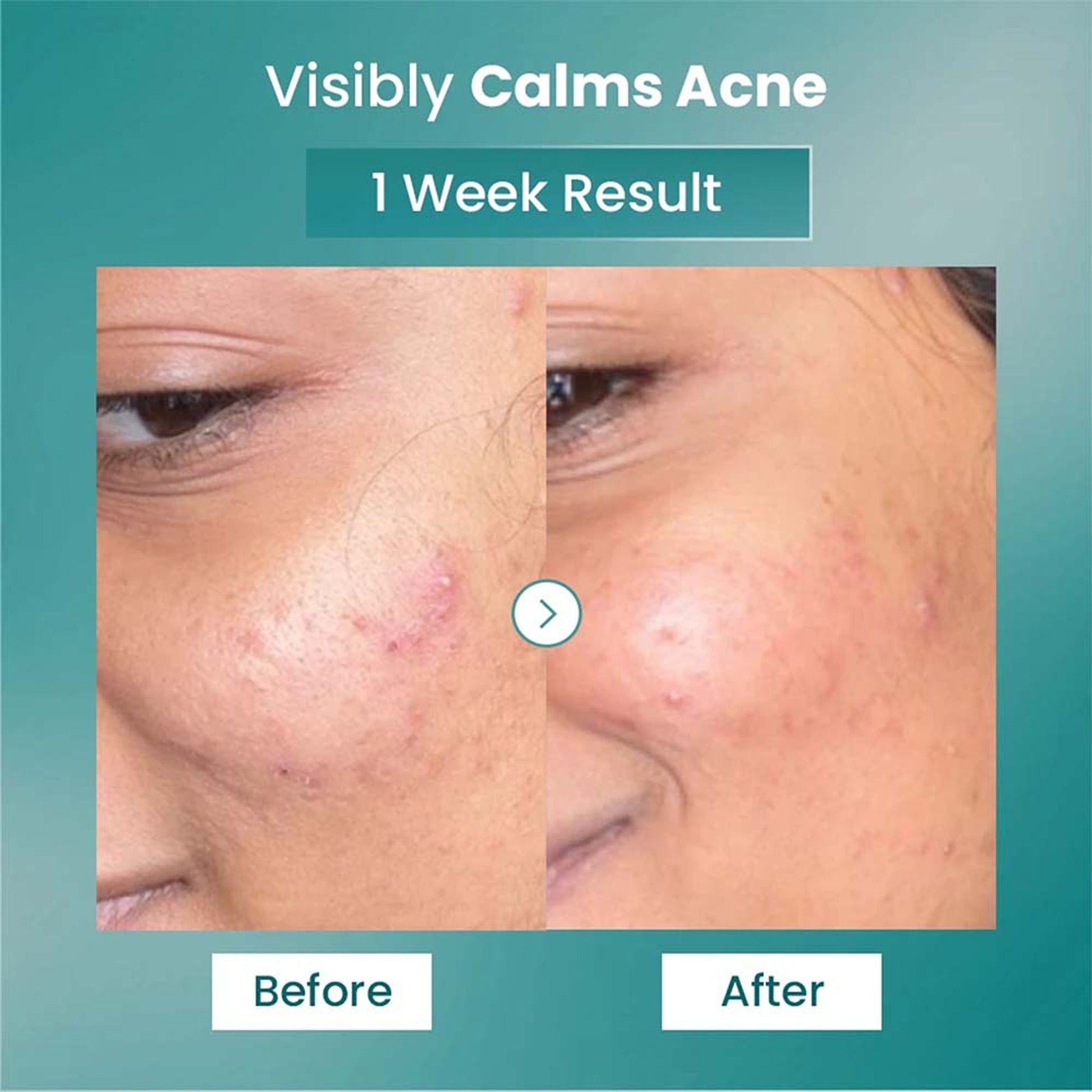 The Solved Skin Spot Fade Advance Repair Serum  Grab2Buy The Solved Skin Grab2Buy