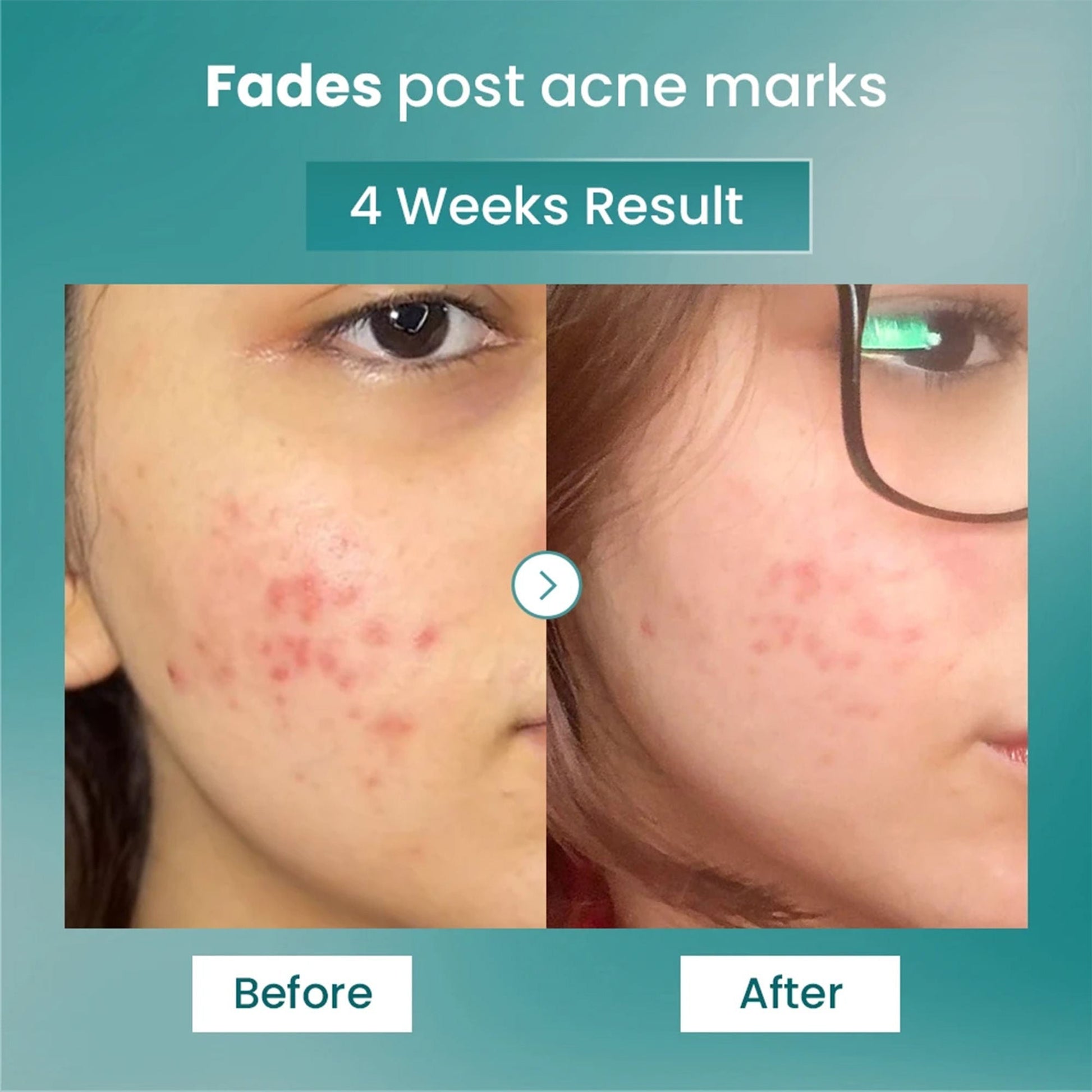 The Solved Skin Spot Fade Advance Repair Serum  Grab2Buy The Solved Skin Grab2Buy