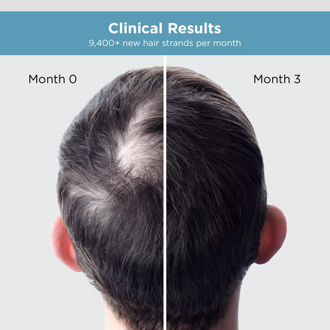 The Man Company Hair Growth Serum For Man  Grab2Buy The Man Company Grab2Buy