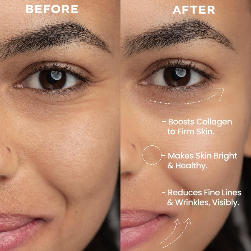 Hyphen By Kriti Sanon 0.05% Retinal Reset Serum, Boosts Collagen, Reduces Wrinkles 