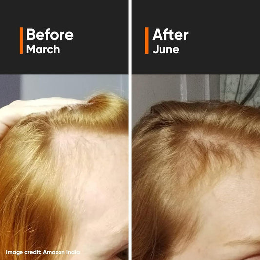 Minimalist Hair Growth Actives 18% - Grab2buy