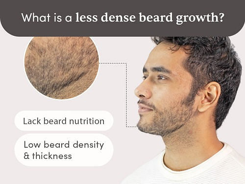Man Matters Beardmax Growth Serum - Grab2buy