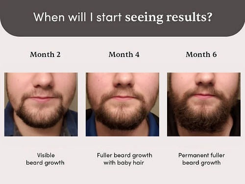 Man Matters Beardmax Growth Serum - Grab2buy