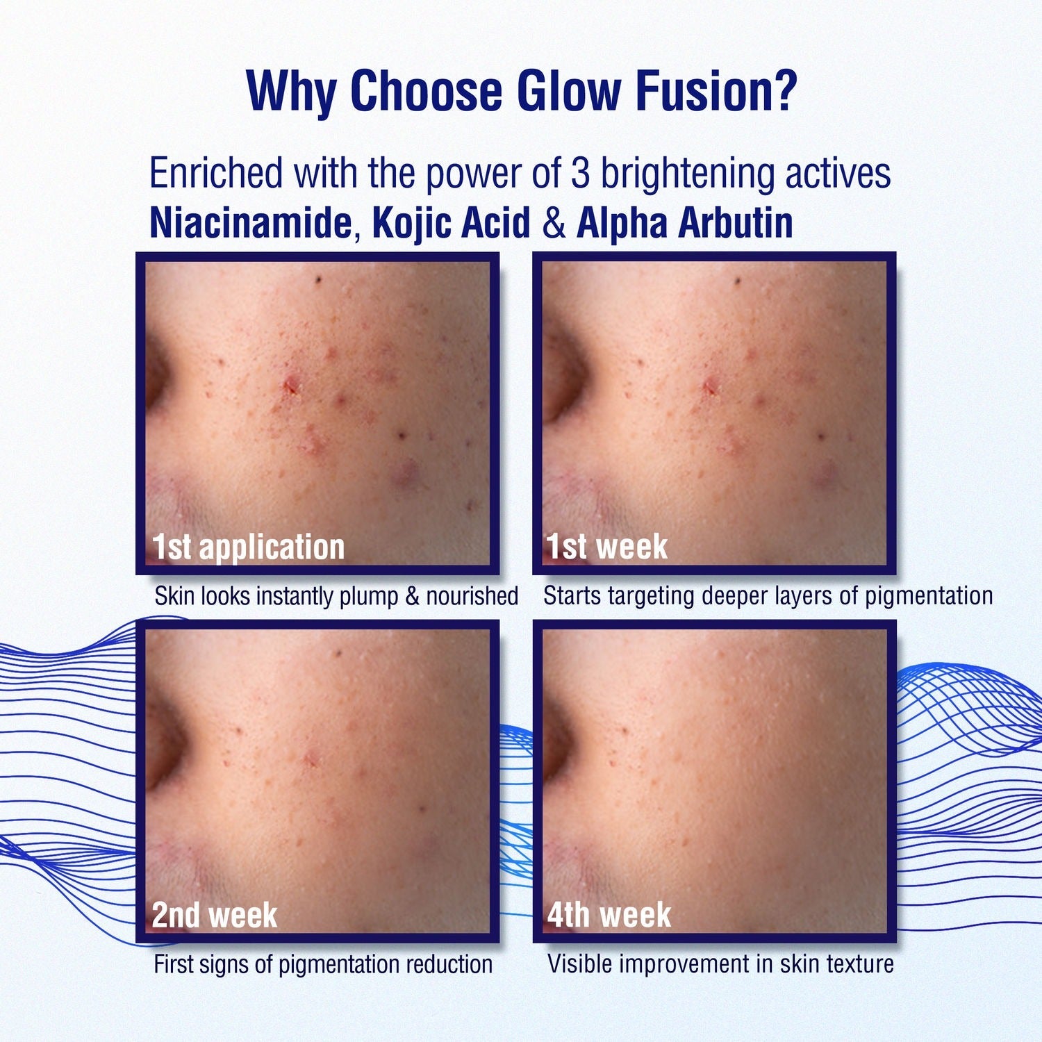 Dermdoc 2% Kojic Acid Night Cream - Grab2buy