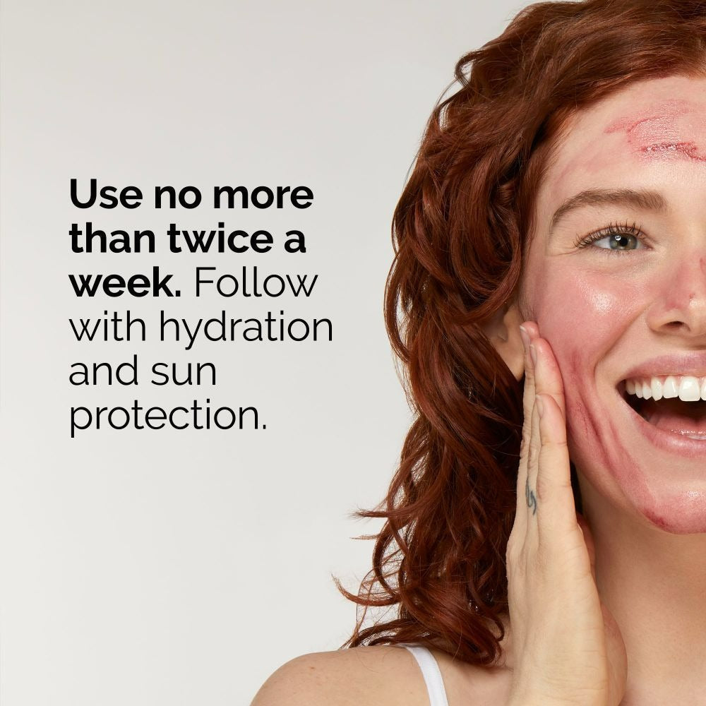 The Ordinary AHA 30% + BHA 2% Peeling Solution Serum  Grab2Buy The Ordinary Grab2Buy
