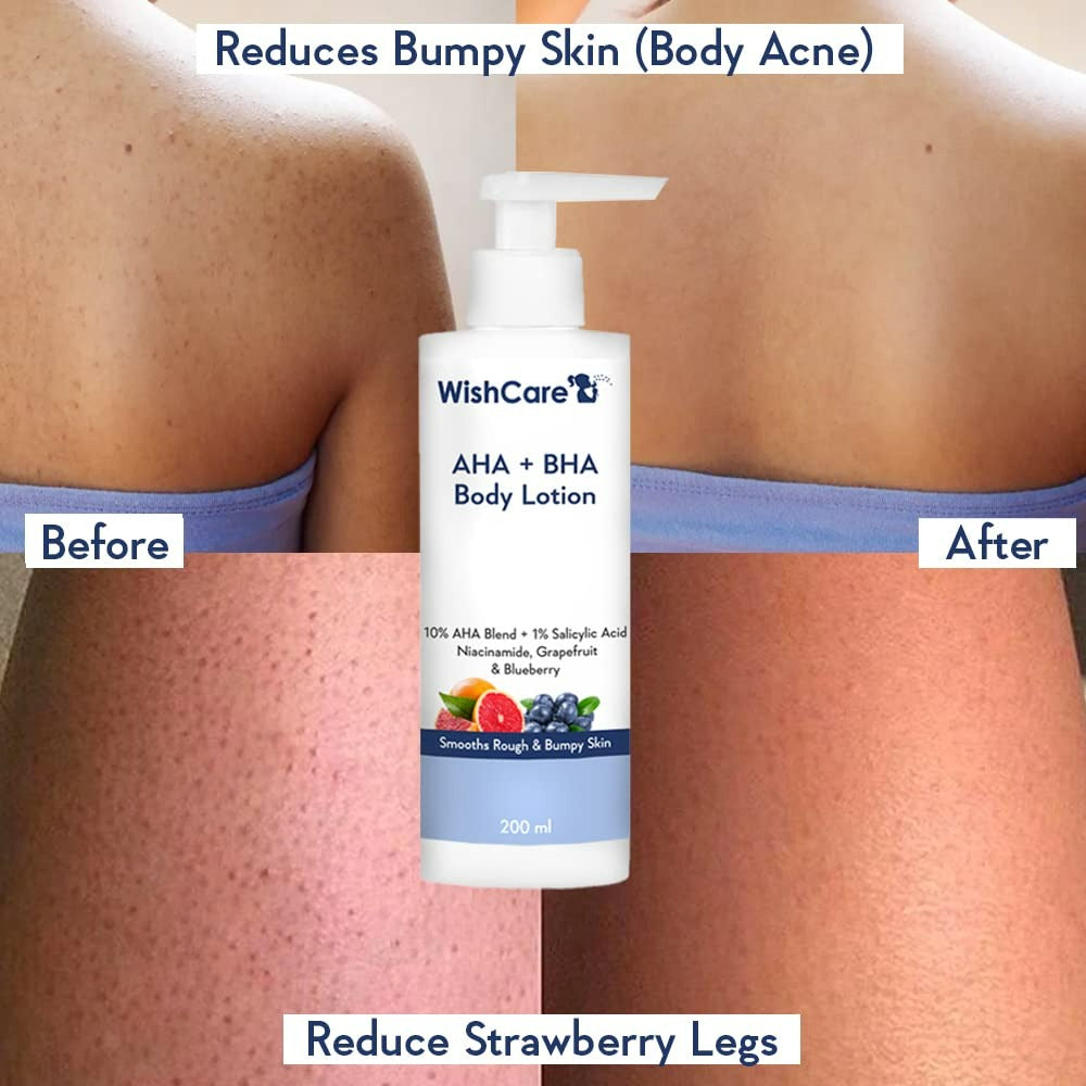 WishCare 10% AHA + 1% BHA Body Lotion for Smooths Rough & Bumpy Skin - Grab2buy