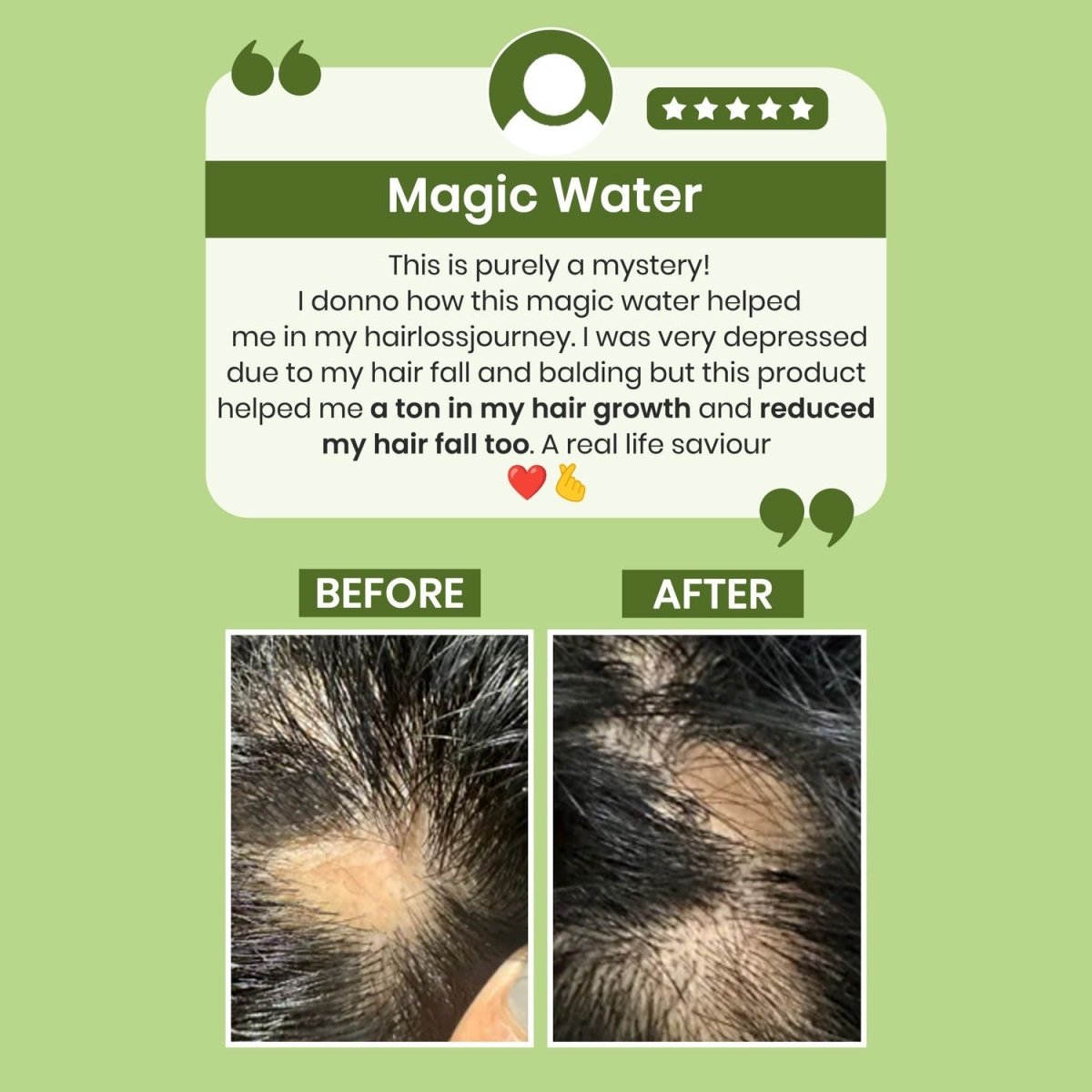 Alps Goodness Rosemary Water for Hair Regrowth - Grab2buy