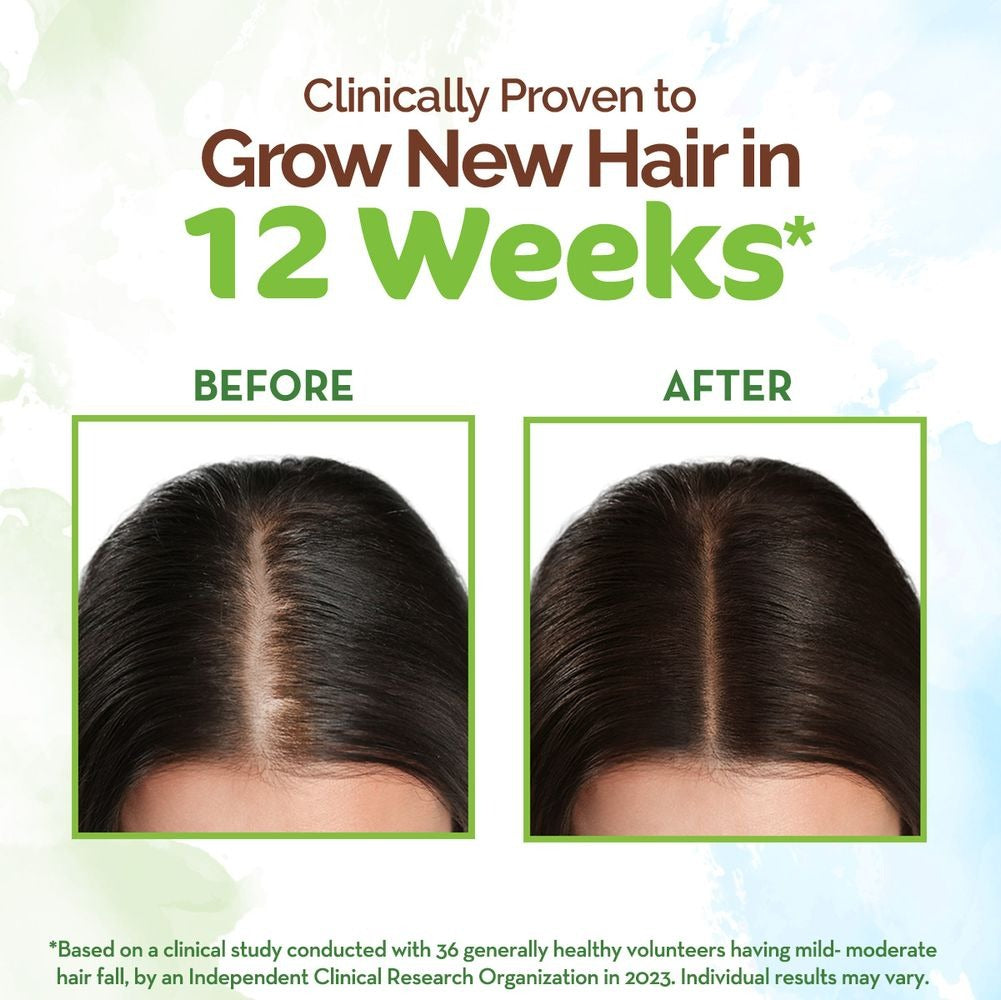 Mamaearth Rosemary Hair Growth Oil with Rosemary & Methi Dana 