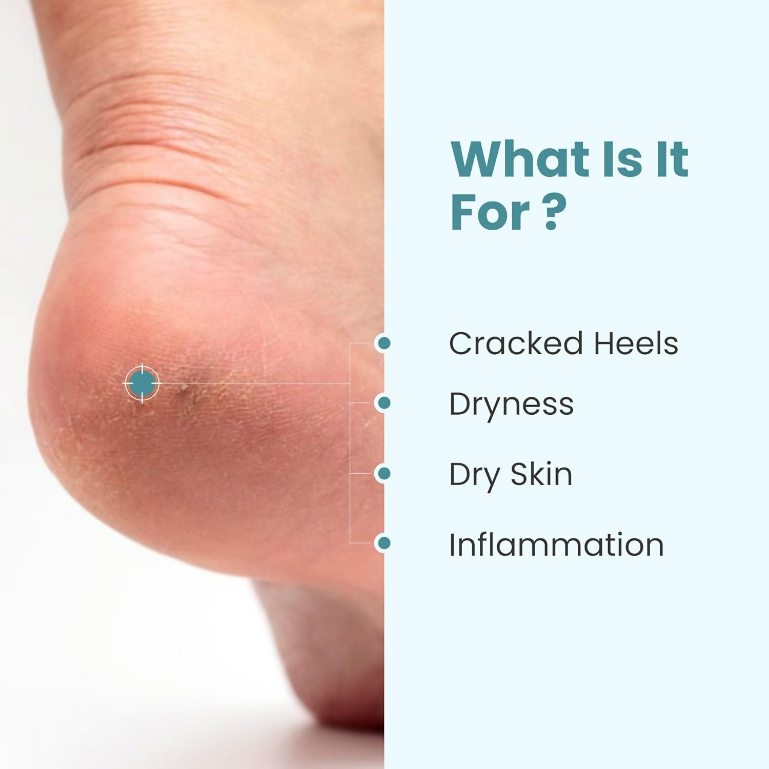 Uniqaya Foot Care Cream Repairs Cracked Heel  Grab2Buy Uniqaya Grab2Buy