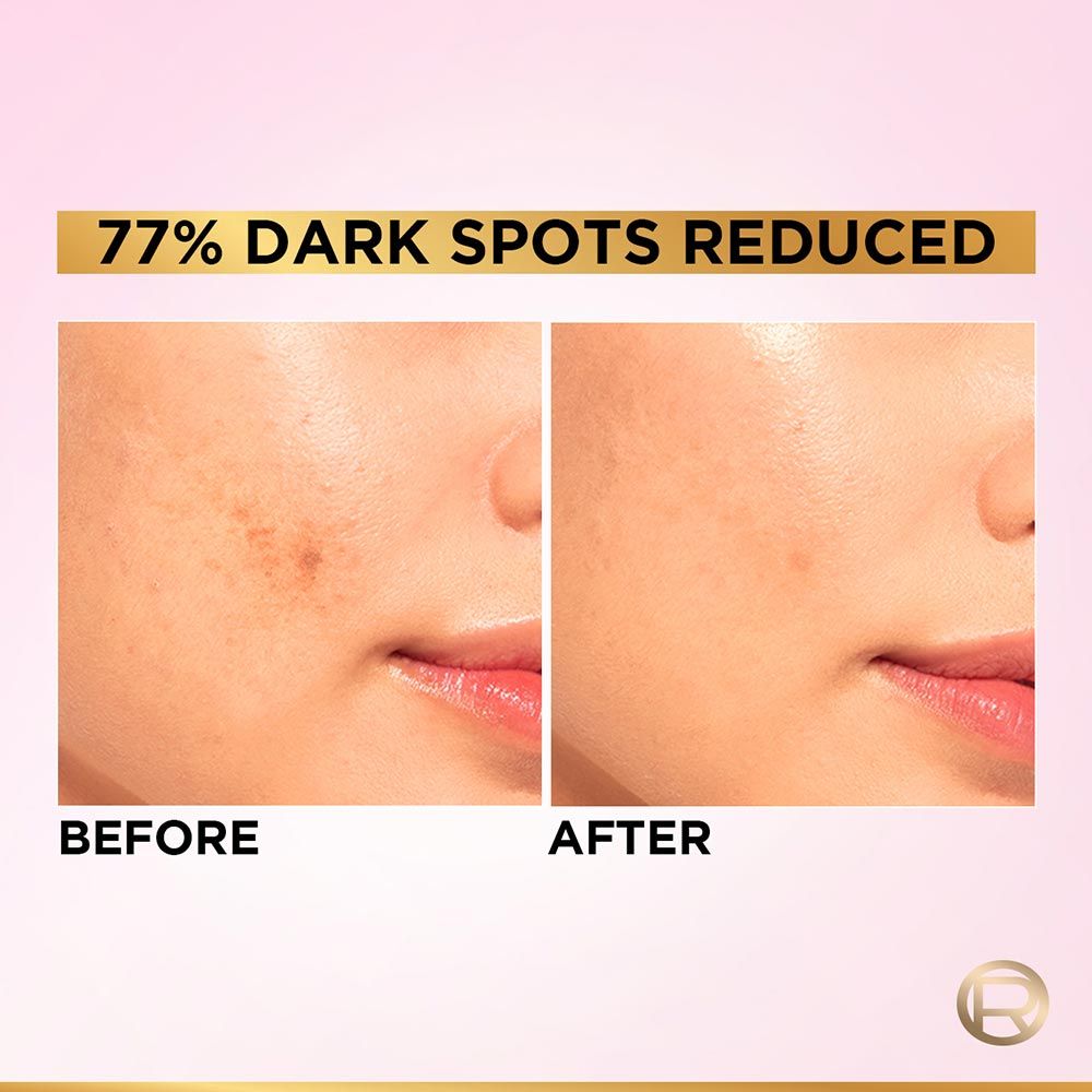 L'Oreal Paris Glycolic Bright 8% [Melasyl + Niacinamide] Face Serum For Brightening Dark Spots - Grab2buy