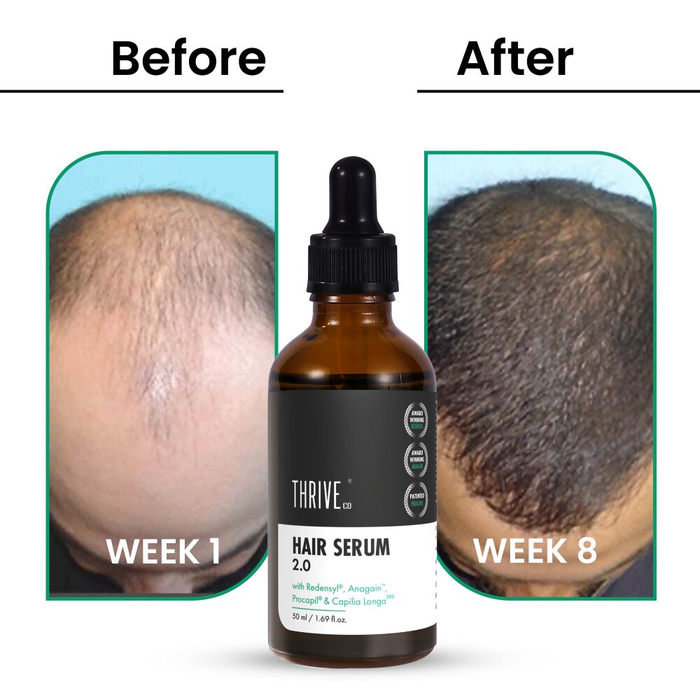 ThriveCo Hair Growth Serum 2.0 - Grab2buy