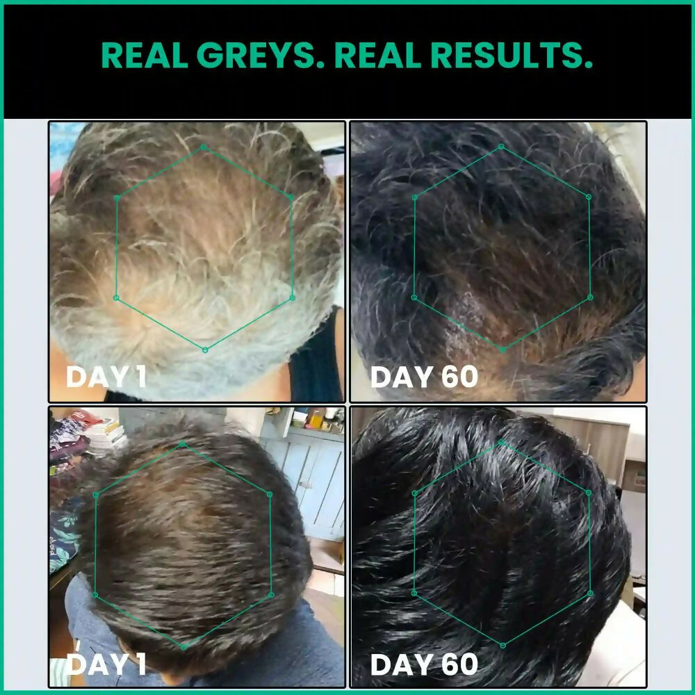 ThriveCo Anti-Greying Hair Prime Serum - Grab2buy