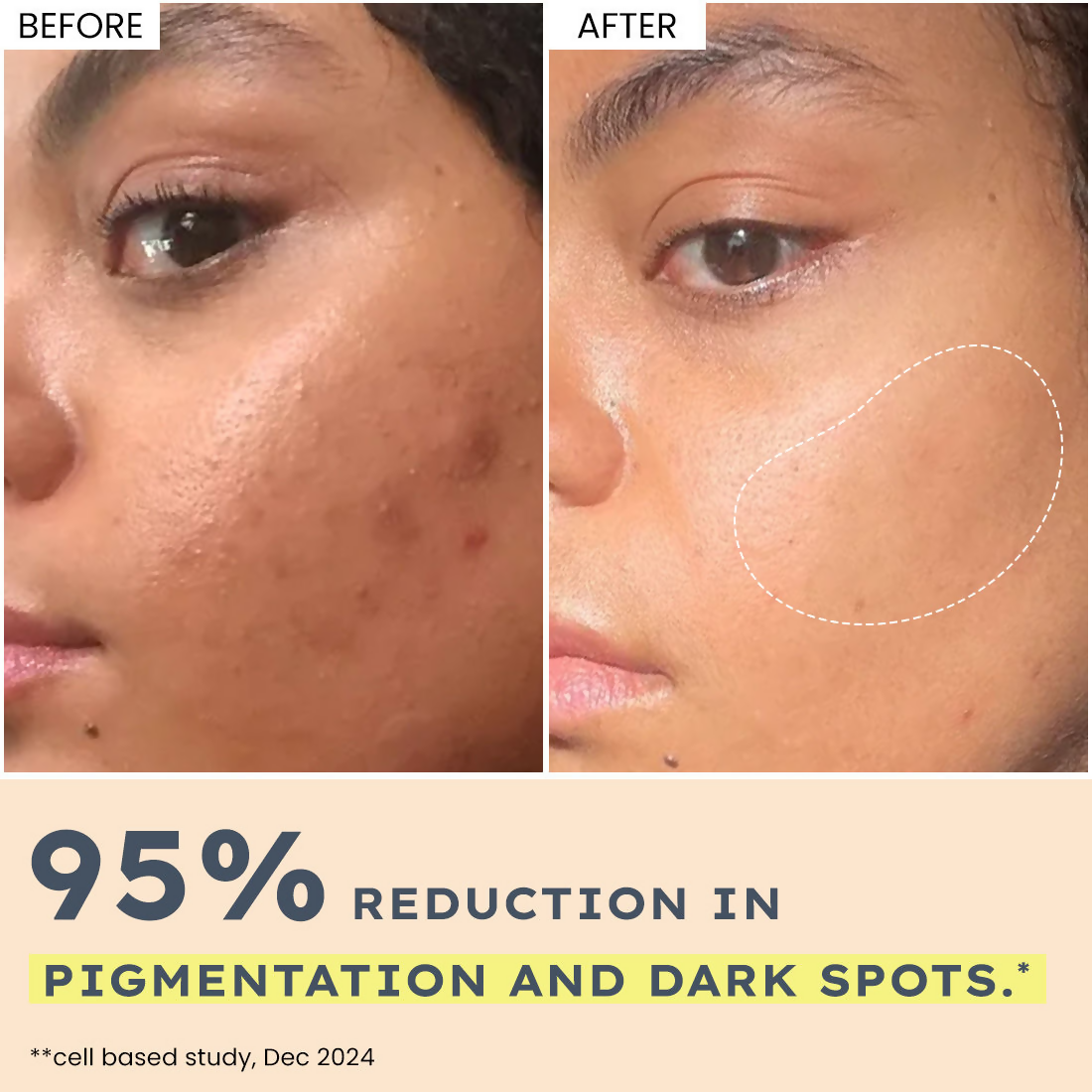 Hyphen By Kriti Sanon 44% Rice Water Brightening Serum Pads (50pcs) 