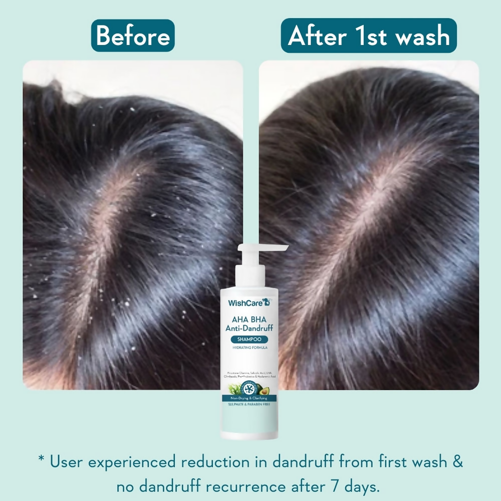 WishCare Aha Bha Anti-Dandruff Shampoo  Grab2Buy Wishcare Grab2Buy