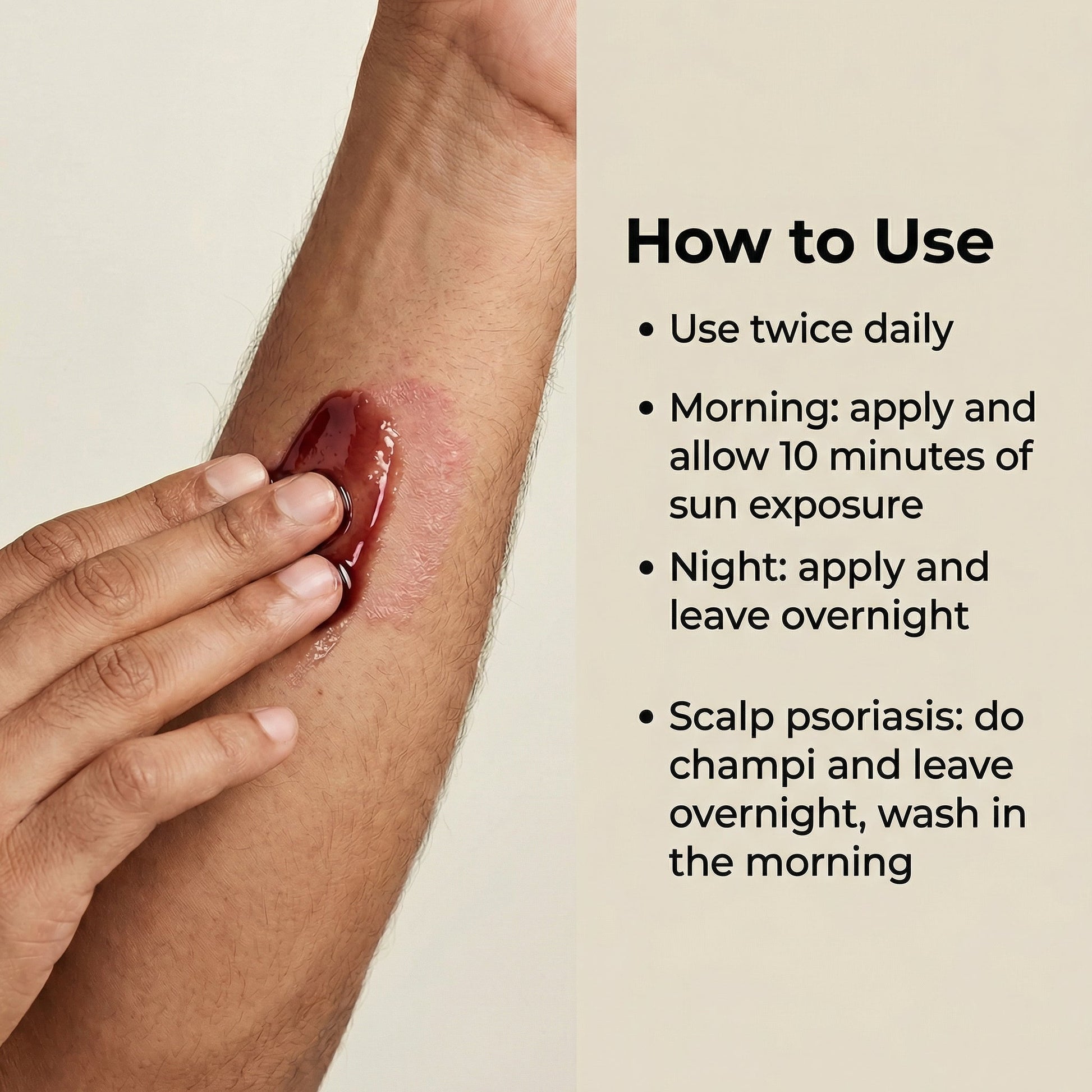 Vedicderm Psoriasis Oil 2-in-1 Skin + Scalp Relief Oil  Grab2Buy VedicDerm Grab2Buy