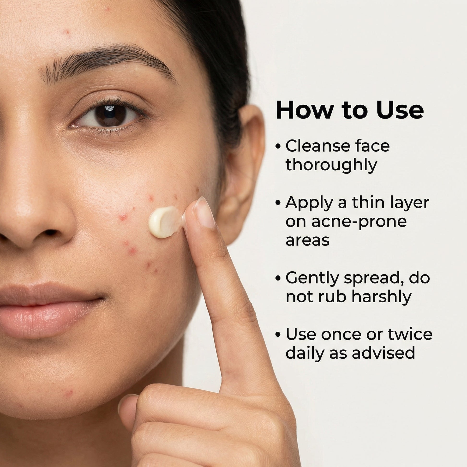 VedicDerm Nano Gold Acne Defence Cream with Turmeric and Nia-Cera-Peptide Complex™️  Grab2Buy VedicDerm Grab2Buy