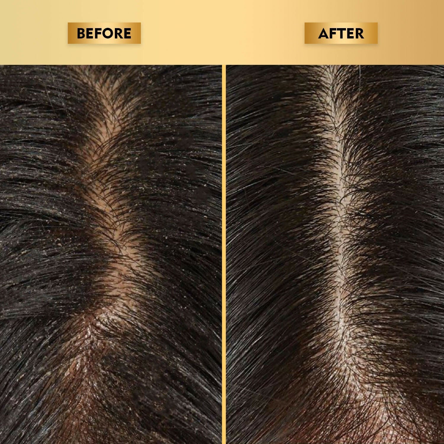 The Skin Story Anti-Dandruff Hair Scalp Serum  Grab2Buy The Skin Story Grab2Buy