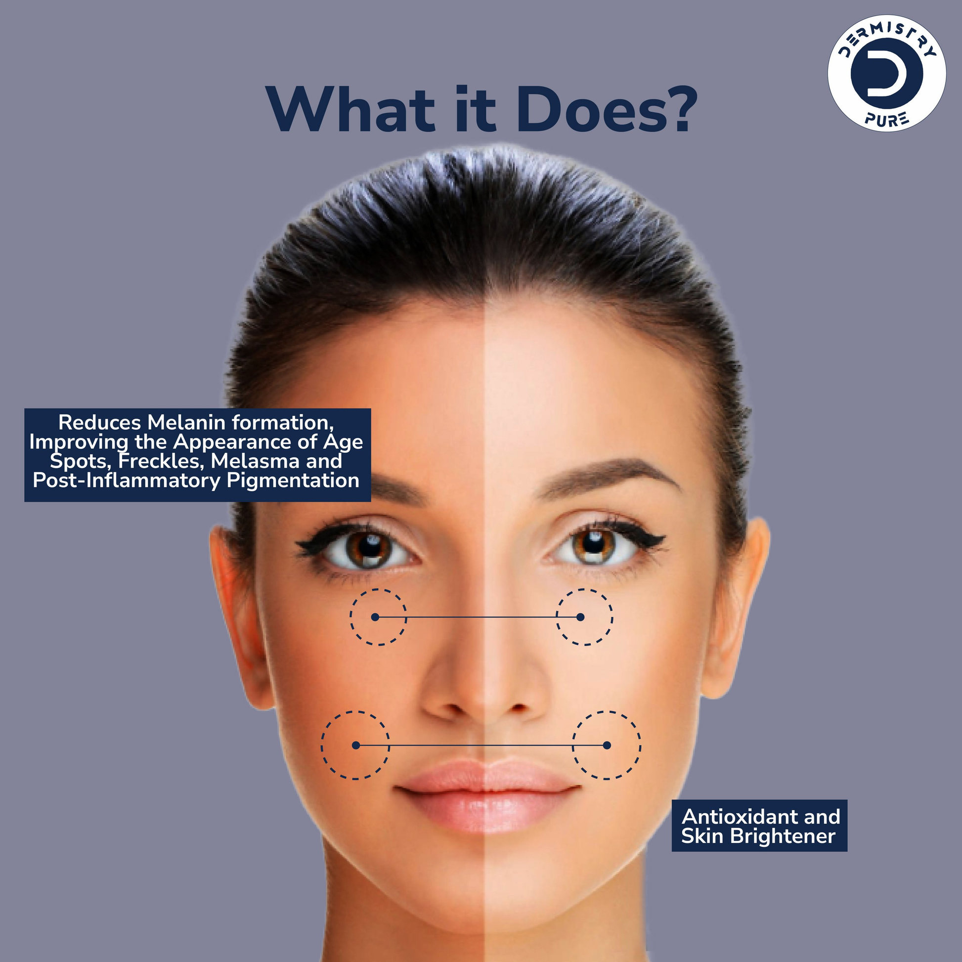 Dermistry 2% Kojic Acid 1% Alpha Arbutin Pigmentation Spots Removal Skin Brightening Face Serum 