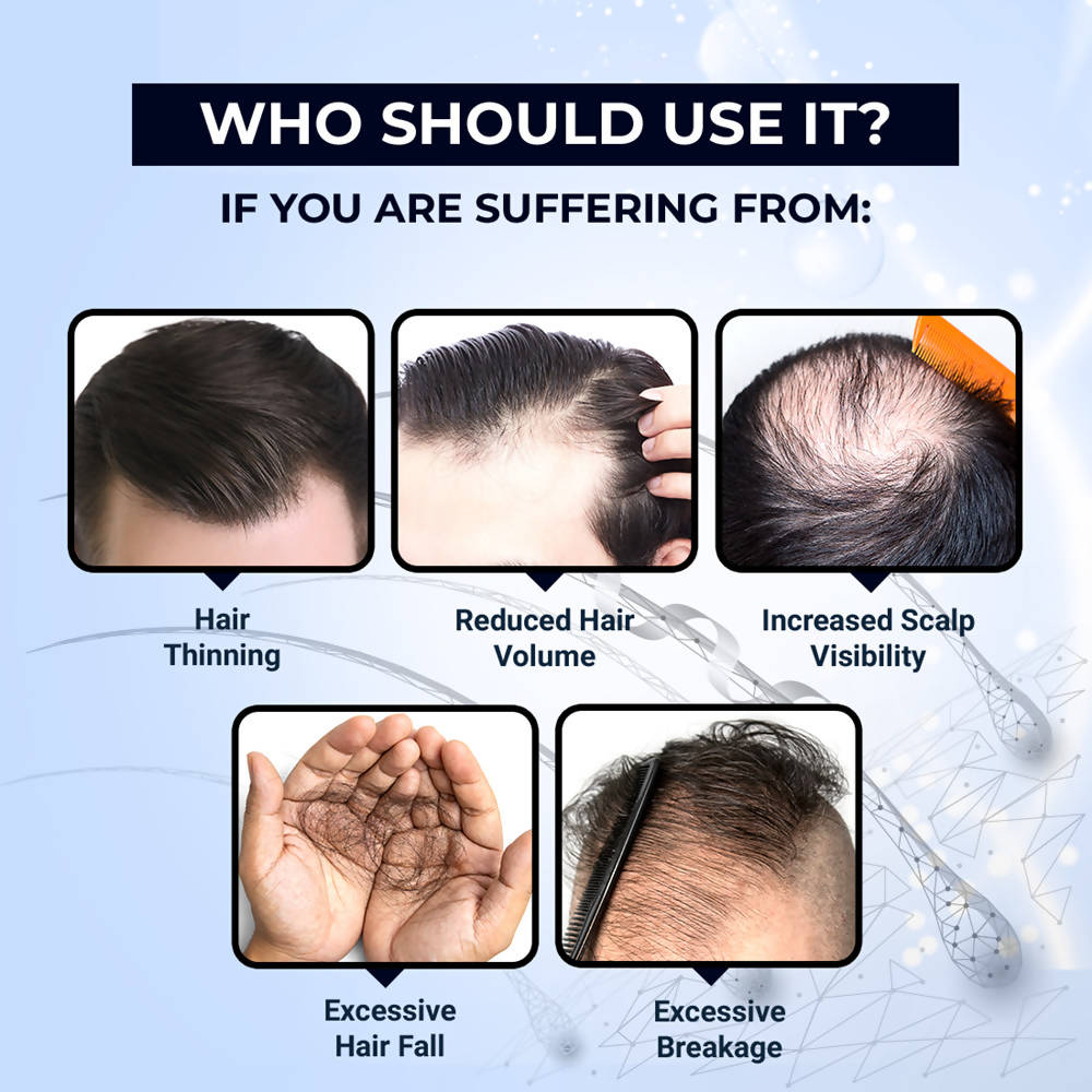 The Man Company Hair Growth Tonic  Grab2Buy The Man Company Grab2Buy