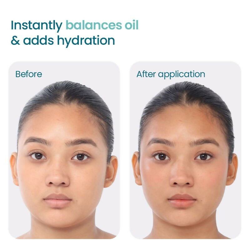 Wishcare 2:1:3 NMF Water Gel Moisturizer for Oily & Sensitive Skin, Oil-Free  Grab2Buy Wishcare Grab2Buy