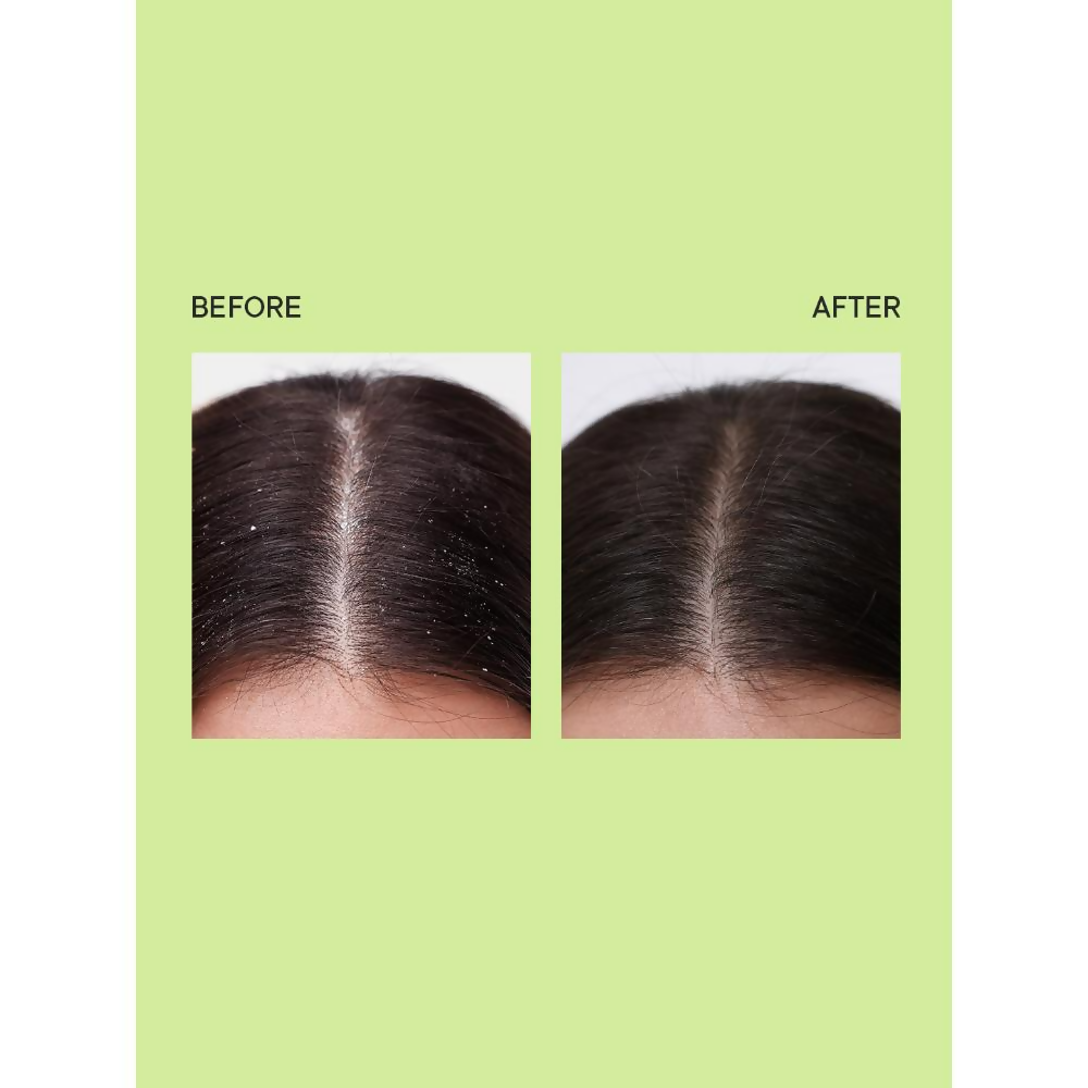 Quench Anti Dandruff Shampoo 