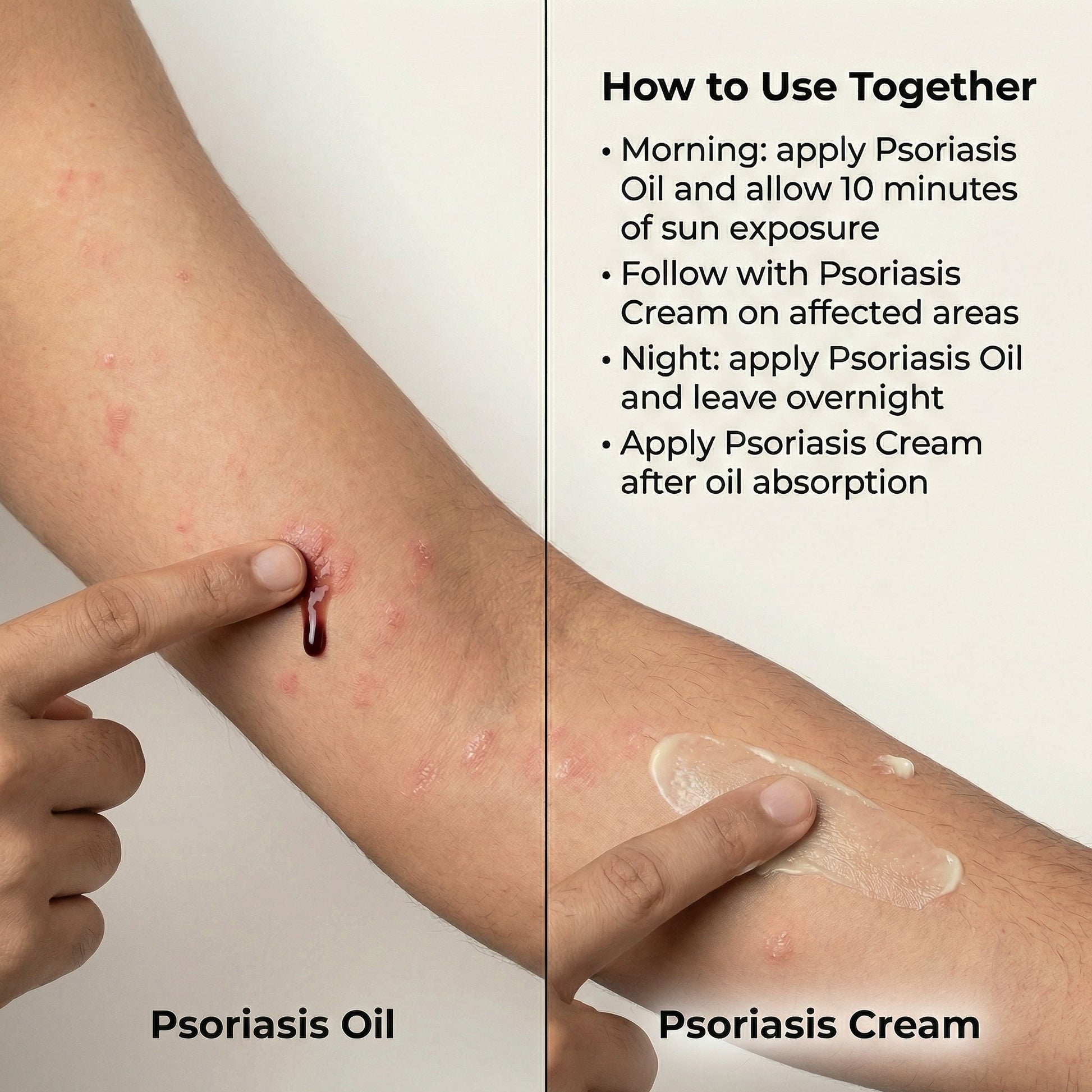 VedicDerm Sensitive Skin Bundle for Psoriasis, Eczema, Atopic Dermatitis  Grab2Buy VedicDerm Grab2Buy