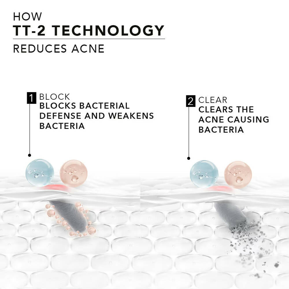 Novology Acne Reduction Serum With 0.1% Thymol + Terpineol 